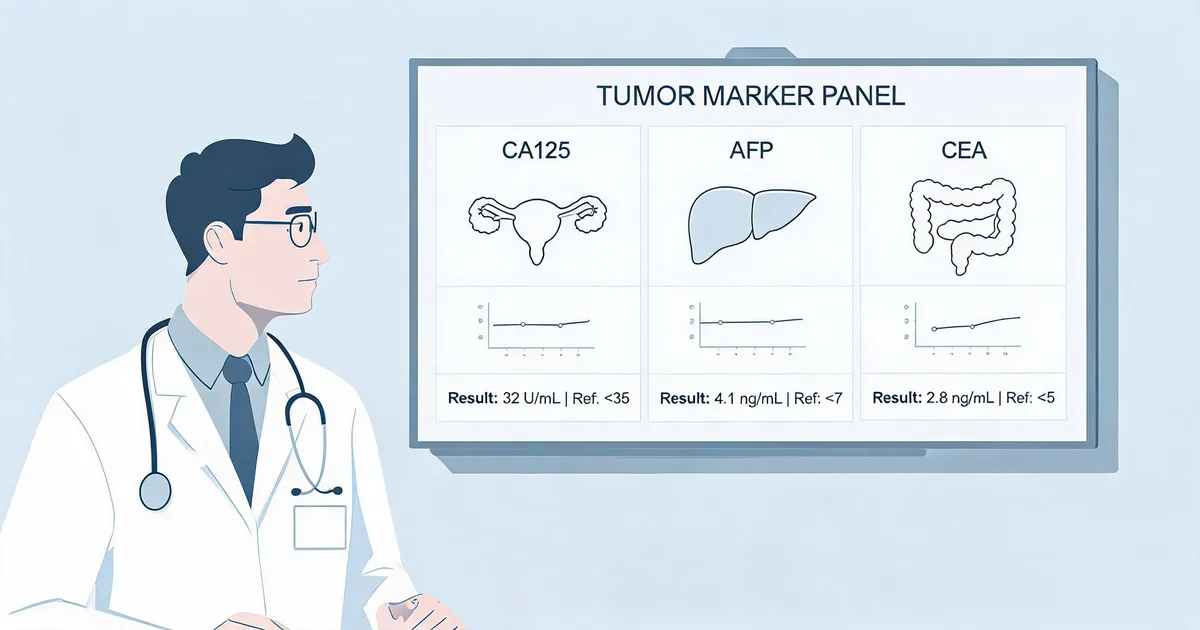 Combined CA125, AFP, and CEA tumor marker panel report showing three independent results with organ-specific reference ranges in a clinical laboratory setting