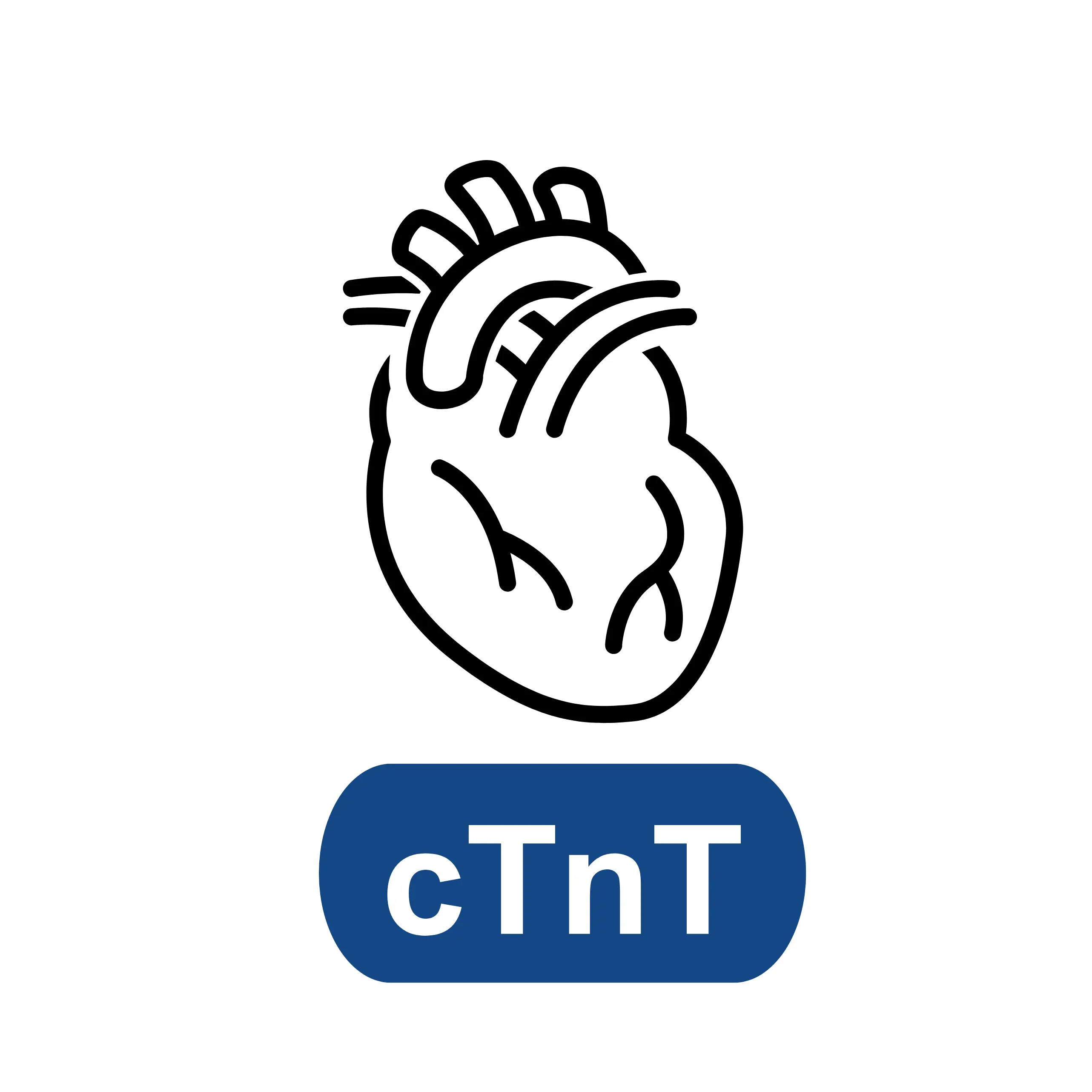Cardiac Troponin T (cTnT)