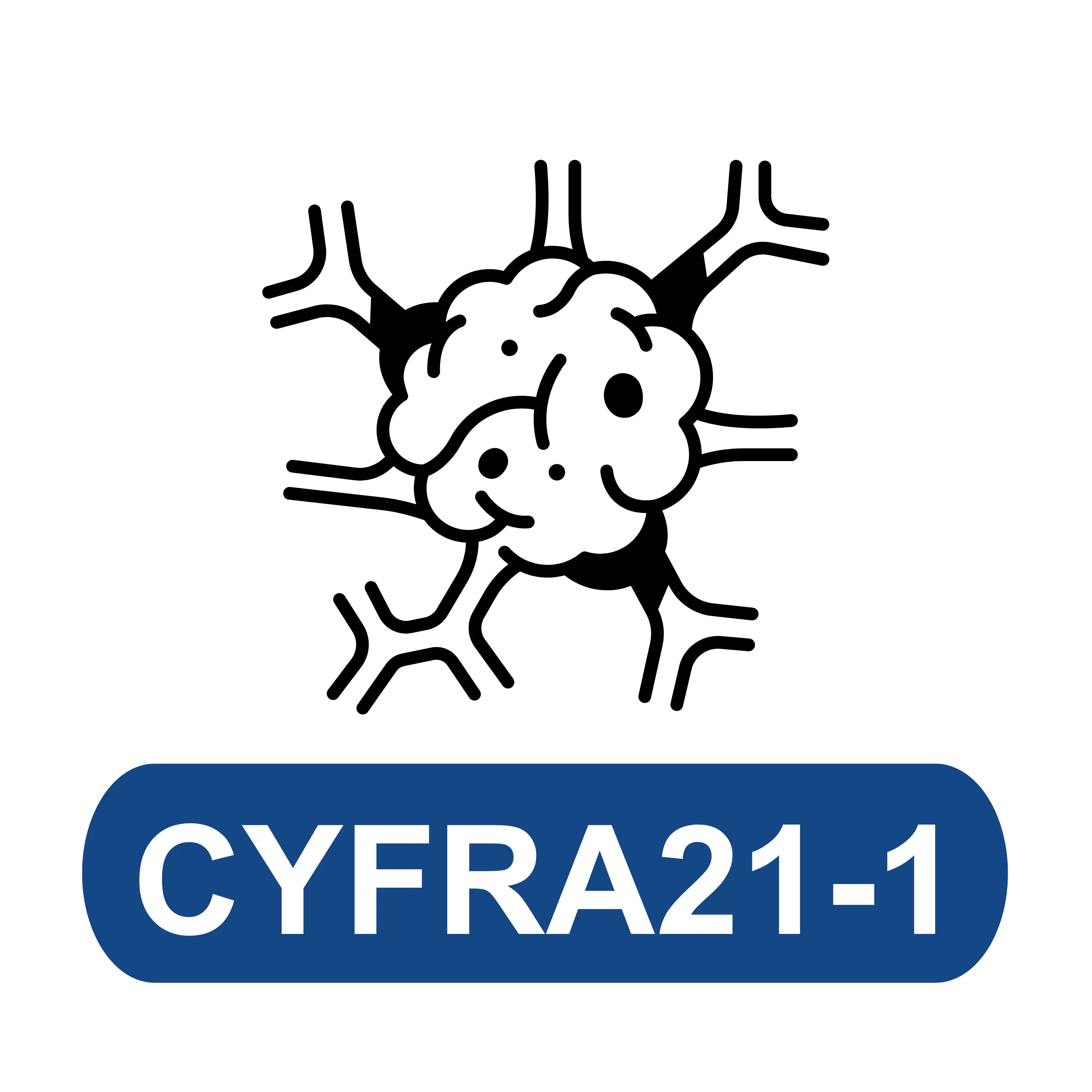 Cytokeratin 19 Fragment (CYFRA21-1)