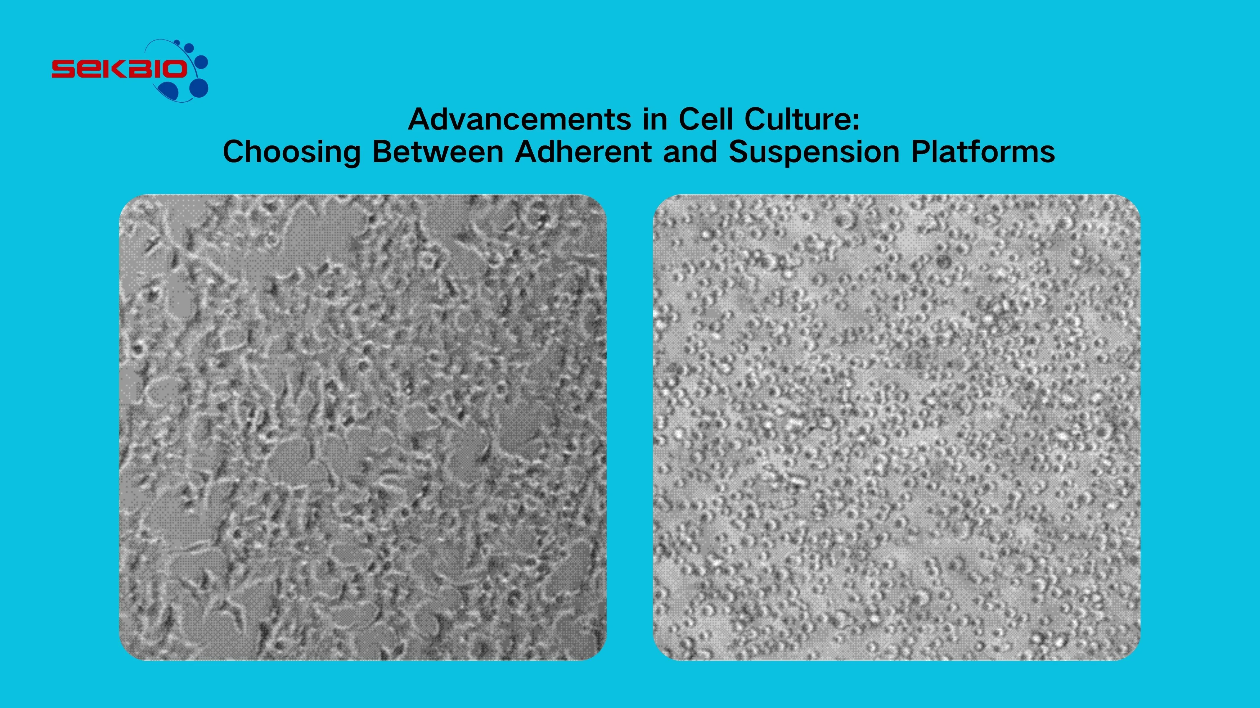 Advancements in Cell Culture: Choosing Between Adherent and Suspension Platforms